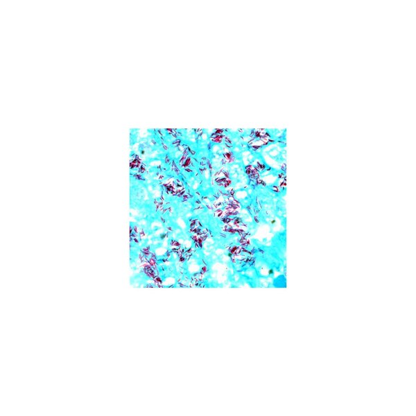 Tissue Control Slide, Acid Fast
